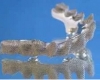 The Implant Restoration Specialists - PREAT Corp.