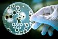 Byproducts from bacteria-causing gum disease incite deadly oral cancer growth