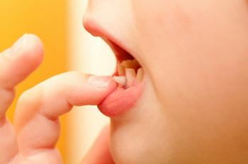 Newly revised guidelines from the American Association of Endodontists may help to save traumatized teeth