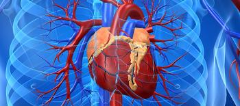 In heart disease patients, gum inflammation reduced by high-dose statins
