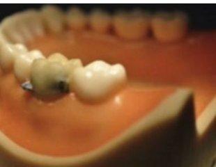 Researchers look for culprit behind oral health problems in HIV-positive patients