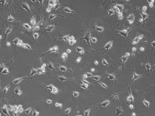 Potential stroke therapy: stem cells from teeth form brain-like cells