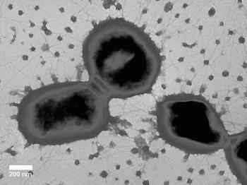 How P. gingivalis causes chronic inflammation in blood vessels